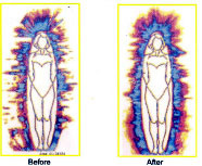 Scalar GDV-Bioeletrography