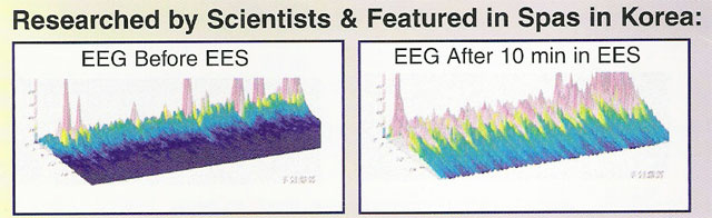 EEG Before EES and after